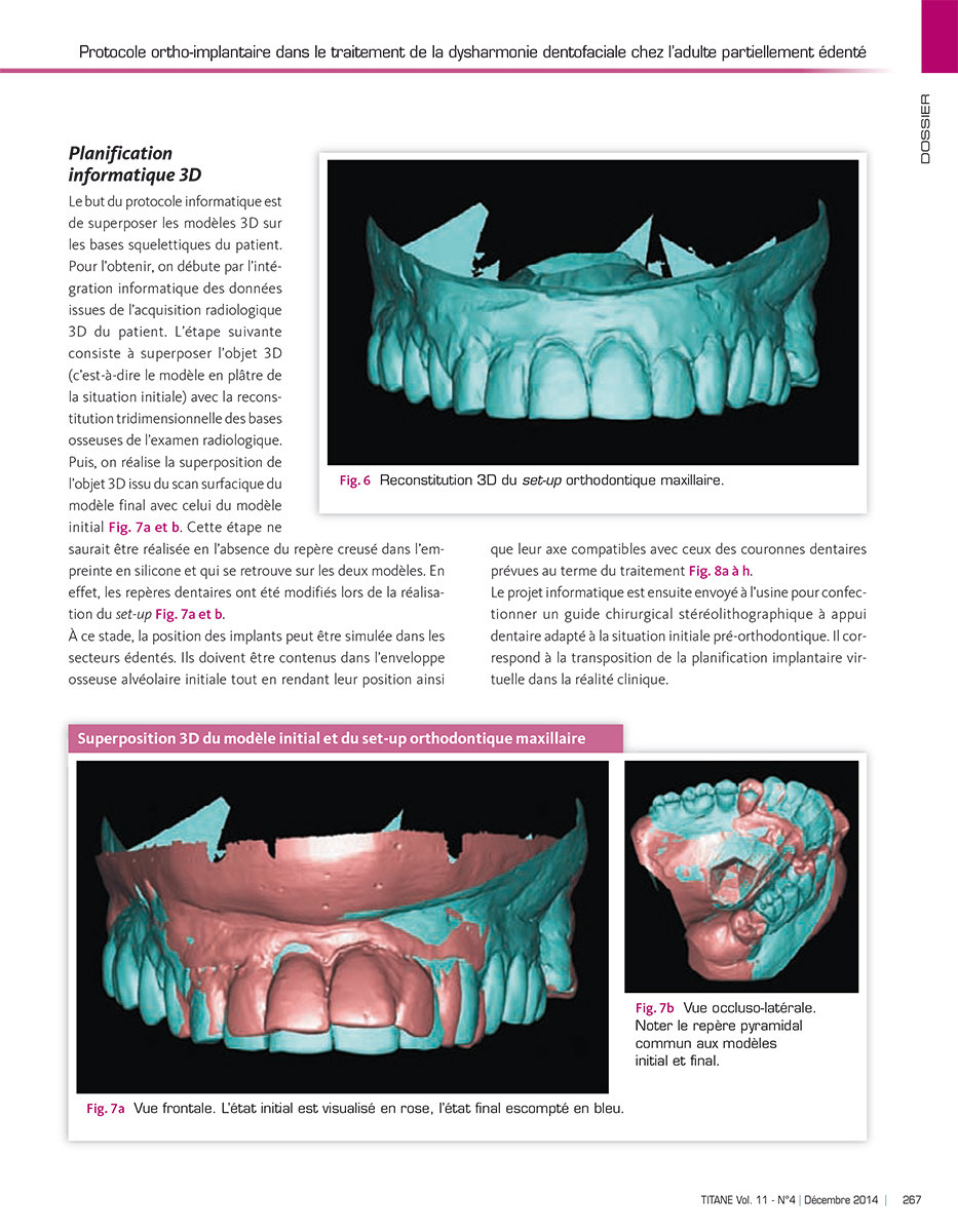 Titane - trimestrial B2B magazine of implantology - inside page